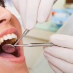 Dental Clinic and Dental Implant: The Complete Guide for Hong Kong Residents